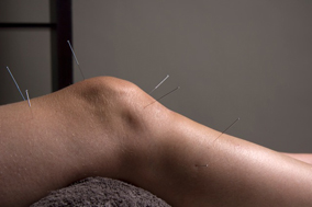 Acupuncture on the knee